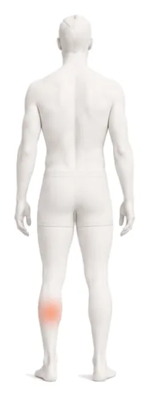 Body illustration with the back of the lower leg and calf highlighted.