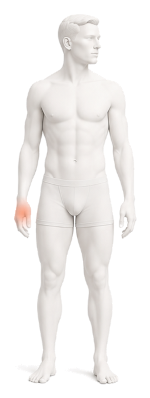 Body illustration with the thumb side of the wrist highlighted.