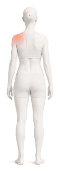 Body illustration with the shoulder highlighted.