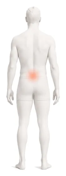 Body illustration with the lower back and leg highlighted.