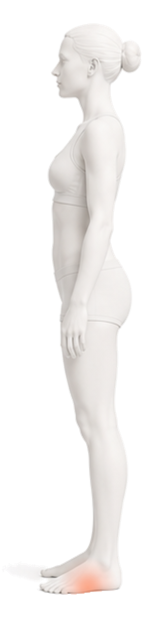 Body illustration with the heel and arch of the foot highlighted.