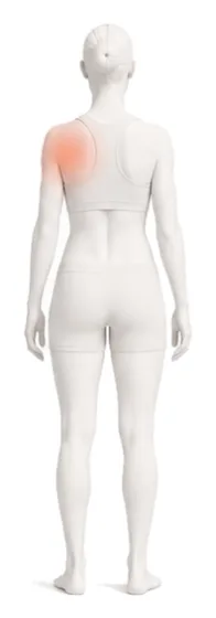 Body illustration with the shoulder highlighted.