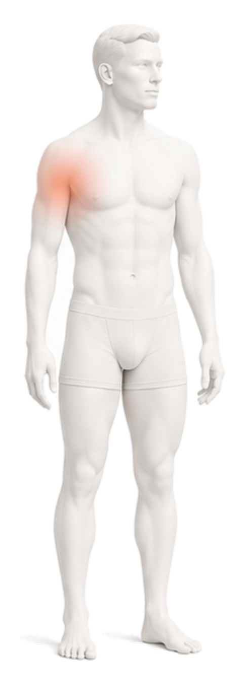 Body illustration with the shoulder highlighted.