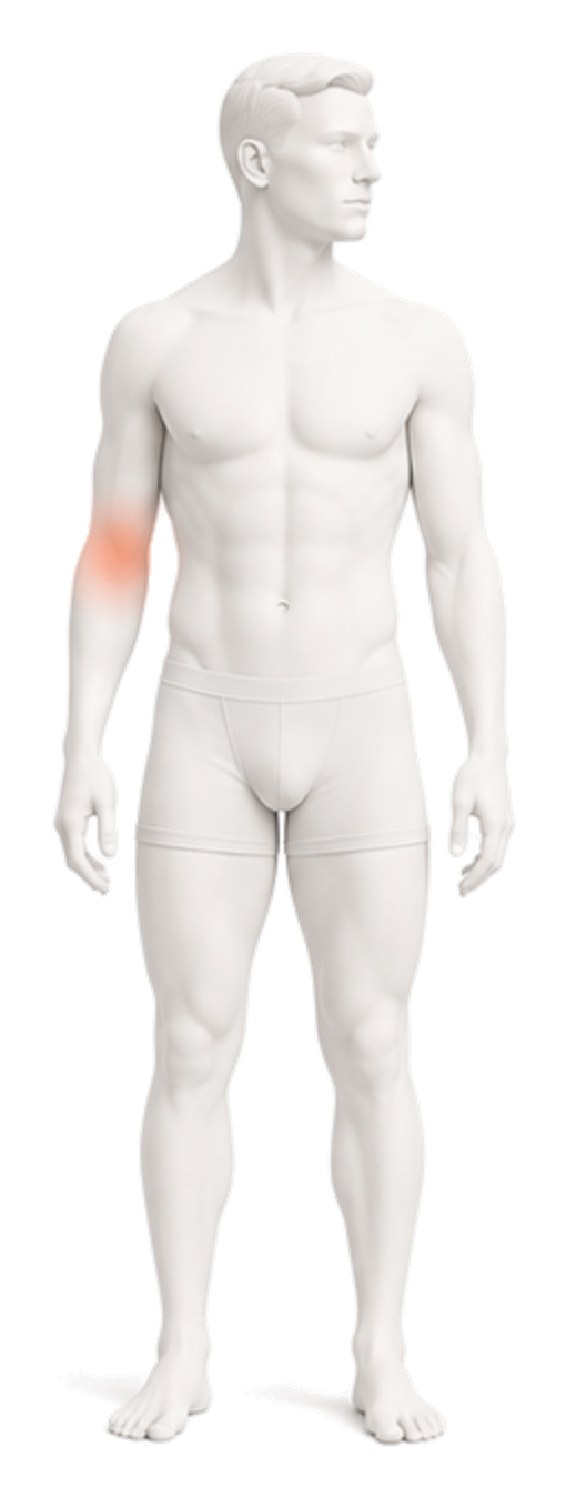 Body illustration with the outside of the elbow and forearm highlighted.