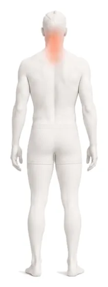 Body illustration with the neck, upper back, and shoulders highlighted.